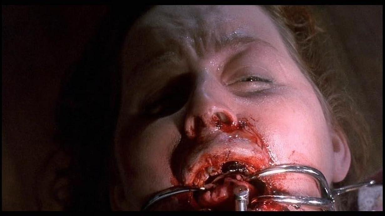 The Dentist 2 streaming ita