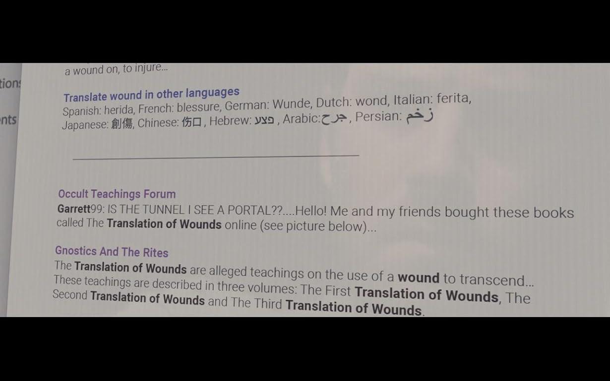Wounds streaming ita